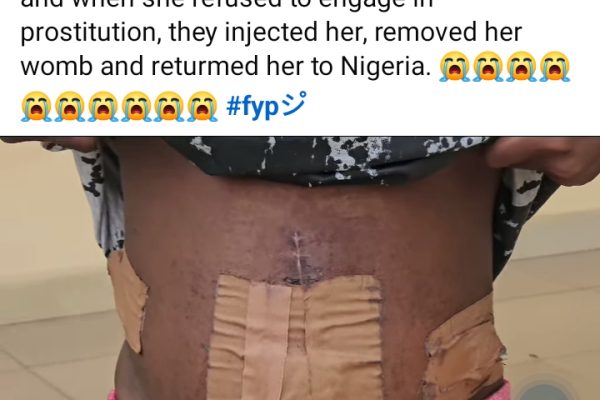 How Traffickers removed  Womb  of Teen Trafficked to Ivory Coast in Nigeria