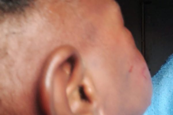 How man beats Toddler daughter shows   Abuse, As  Police Arrest Father in Nigeria